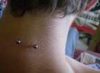 nape surface ring nape surface ring